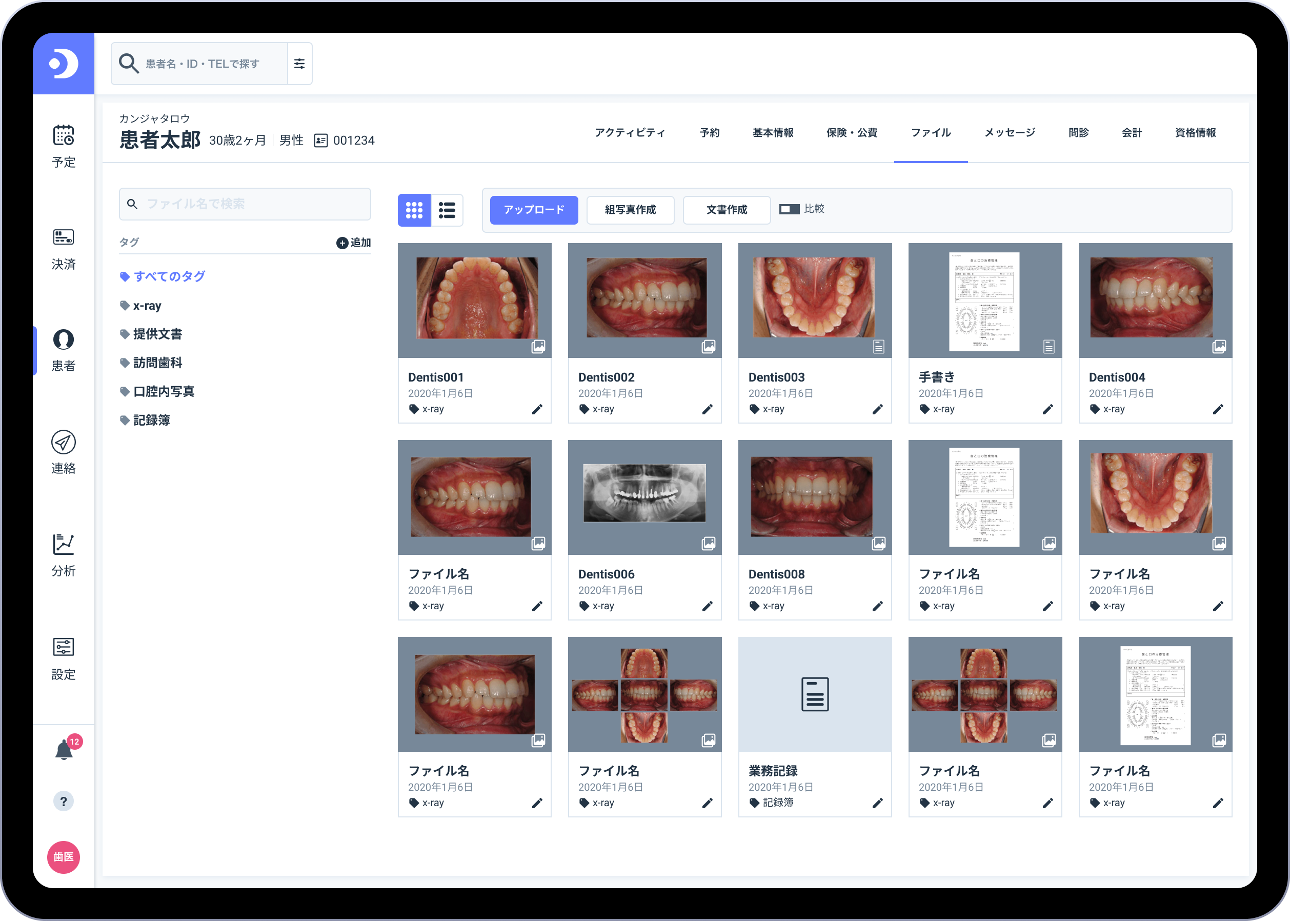 Dentisサブカルテ画面イメージ